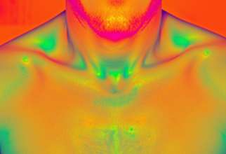 Thermal Imaging